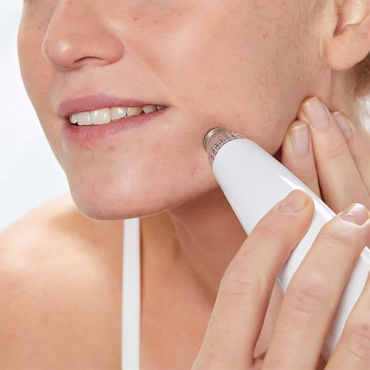 Aspirateur-a-points-noirs-electrique-visage-nettoyeur-de-pores-acne-elimination-des-taches-noires